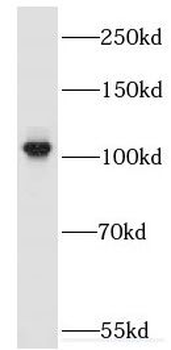 RAPGEF4 Rabbit Polyclonal Antibody