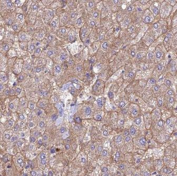 RAPGEF4 Rabbit Polyclonal Antibody