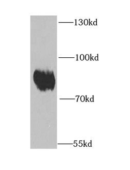 EPB41 Rabbit Polyclonal Antibody