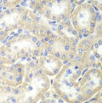 EPB41 Rabbit Polyclonal Antibody