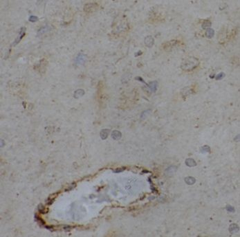 EPHA6 Rabbit Polyclonal Antibody