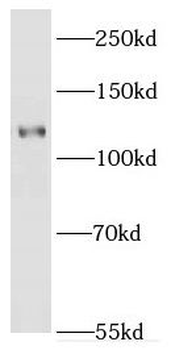 EPHA8 Rabbit Polyclonal Antibody