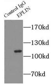 LIMA1 Rabbit Polyclonal Antibody