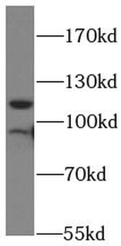 LIMA1 Rabbit Polyclonal Antibody