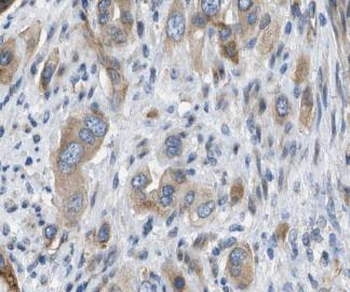 LIMA1 Rabbit Polyclonal Antibody