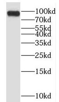 EPS15L1 Rabbit Polyclonal Antibody