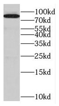 EPS8L2 Rabbit Polyclonal Antibody