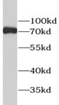ESR1 Rabbit Polyclonal Antibody