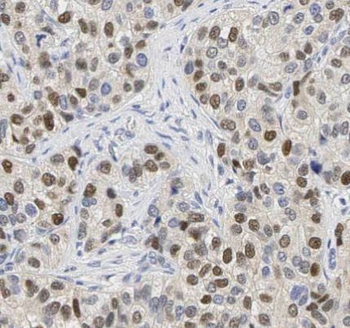 ESR1 Rabbit Polyclonal Antibody