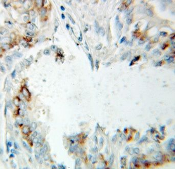HSD17B10 Antibody