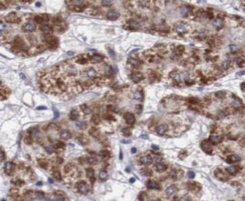 ERAP2 Rabbit Polyclonal Antibody