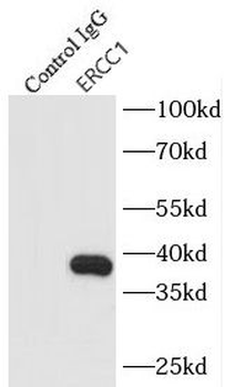 ERCC1 Antibody