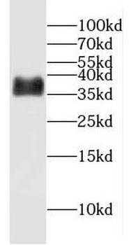 ERCC1 Antibody