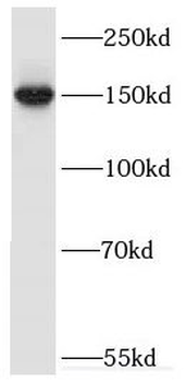 ERCC6 Antibody