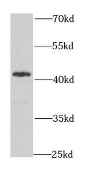 ERGIC2 Rabbit Polyclonal Antibody