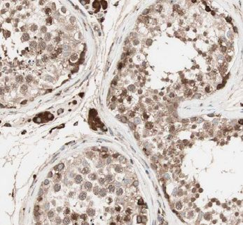 ERI1 Rabbit Polyclonal Antibody