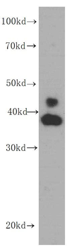ERK1/2 Antibody