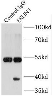 ERLIN1 Rabbit Polyclonal Antibody