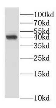 ERLIN1 Rabbit Polyclonal Antibody