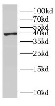 ERLIN2 Rabbit Polyclonal Antibody