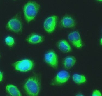 PDIA4 Rabbit Polyclonal Antibody