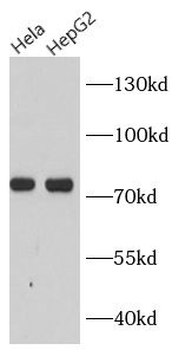 PDIA4 Rabbit Polyclonal Antibody