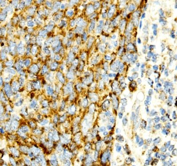 PDIA4 Rabbit Polyclonal Antibody