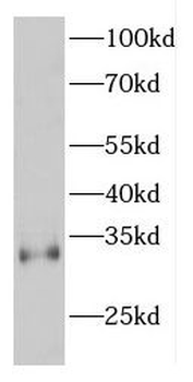 ESPN Rabbit Polyclonal Antibody