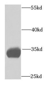 ETFA Rabbit Polyclonal Antibody