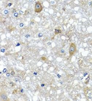 ETFA Rabbit Polyclonal Antibody