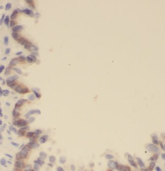 EVI2B Rabbit Polyclonal Antibody