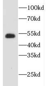 EVL Rabbit Polyclonal Antibody