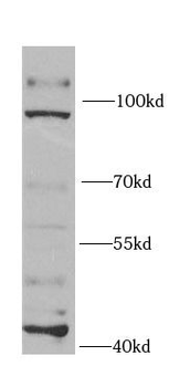 EXO1 Rabbit Polyclonal Antibody