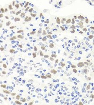 EXO1 Rabbit Polyclonal Antibody