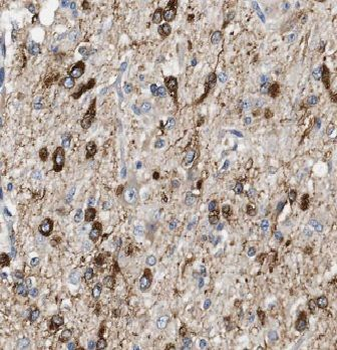 EXOC1 Rabbit Polyclonal Antibody