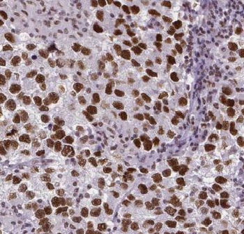 EXOC5 Rabbit Polyclonal Antibody