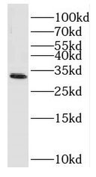 EXOSC2 Rabbit Polyclonal Antibody