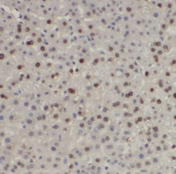 EXOSC2 Rabbit Polyclonal Antibody