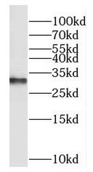 EXOSC3 Rabbit Polyclonal Antibody