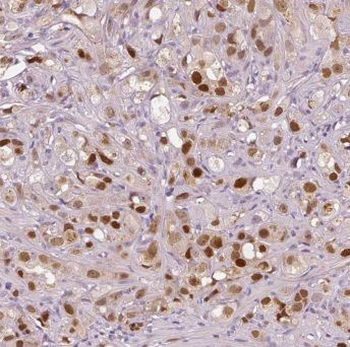 EXOSC3 Rabbit Polyclonal Antibody