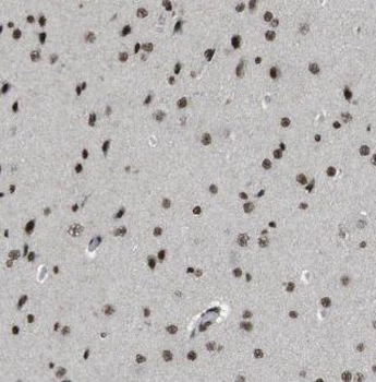 EXOSC4 Rabbit Polyclonal Antibody
