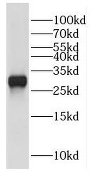 EXOSC5 Rabbit Polyclonal Antibody