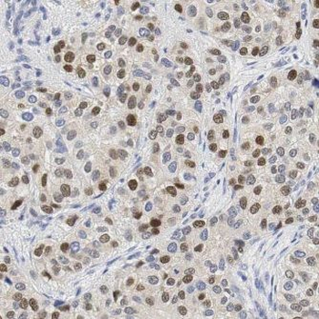 EXOSC5 Rabbit Polyclonal Antibody