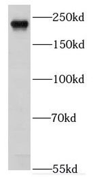 EXPH5 Rabbit Polyclonal Antibody
