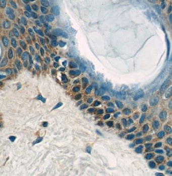 EXPH5 Rabbit Polyclonal Antibody