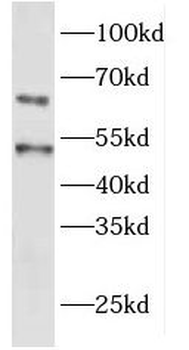 EYA1 Antibody