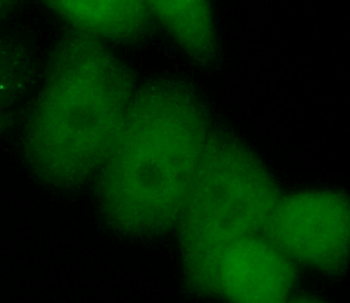 EZH2 Rabbit Polyclonal Antibody