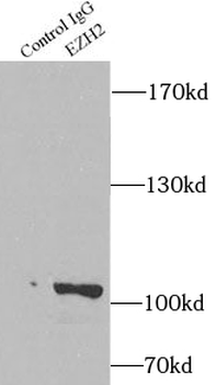 EZH2 Rabbit Polyclonal Antibody