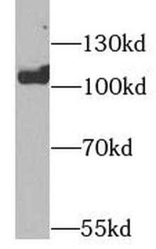 EZH2 Rabbit Polyclonal Antibody