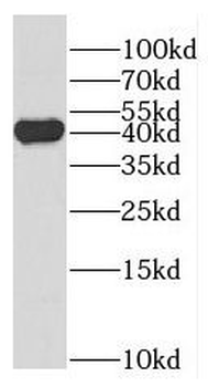 FA2H Rabbit Polyclonal Antibody